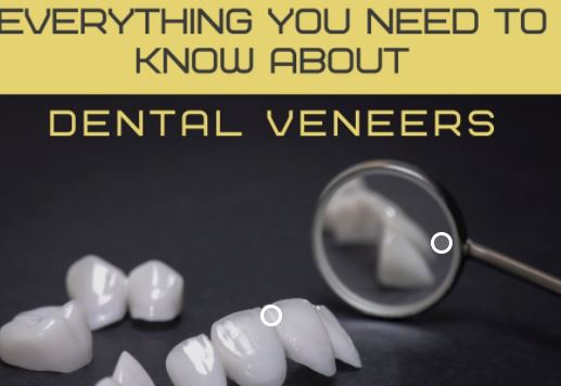 Dental Veneers