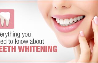 Teeth Whiteing