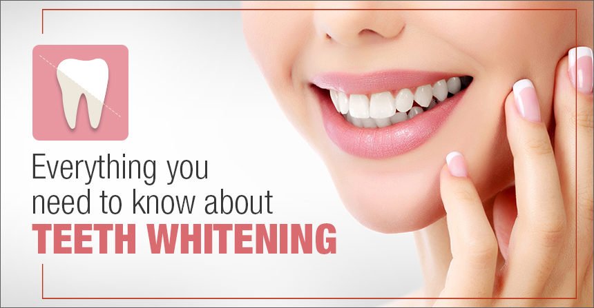 Teeth Whiteing