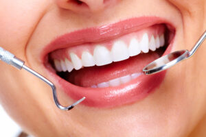 Invisalign Teeth Whitening Hampshire