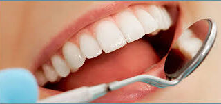 professional teeth whitening treatments