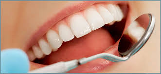 professional teeth whitening treatments