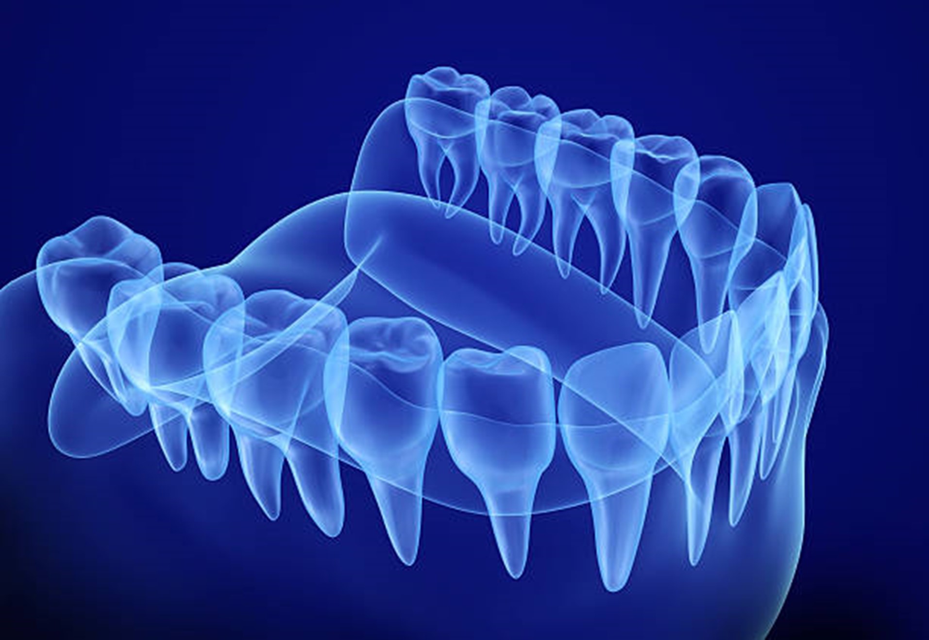 Dental X-Rays